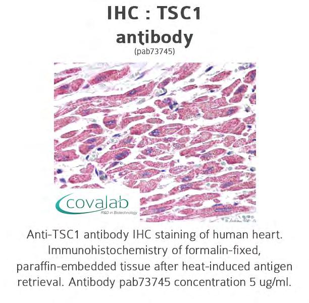 Antibodies TSC1 pab73745 VPS43 pab50333 Yorkie homolog pab0848-p Anti-TSC1 IHC staining of human heart.