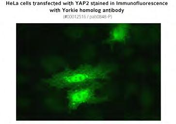 Anti-YAP1 homolog staining of HeLa cells expressing YAP1.