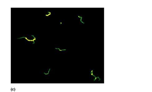 forming of antigen-antibody lattice 19 20 RPR VDRL Slide Non reactive Reactive 21 22 Syphilis: Treponemal Tests FTA FTA-ABS Immunofluorescent procedure using a non syphilitic (Reiter) strain of T.