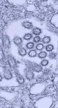 Understanding Avian Influenza Virus Influenza Virus Type: A, B, C, Influenza Type A: Human, Swine, Avian Avian Influenza