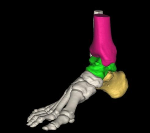 The scans were performed using a custom-made loading device of the foot (Rakuhoku Prosthetic and Orthotic Manufacturing Co.