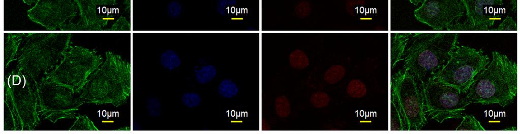micelles (C and D) for 2 h: (A) and (C) cells without pretreatment; (B) and (D) cells pretreated with 10 mm GSH.