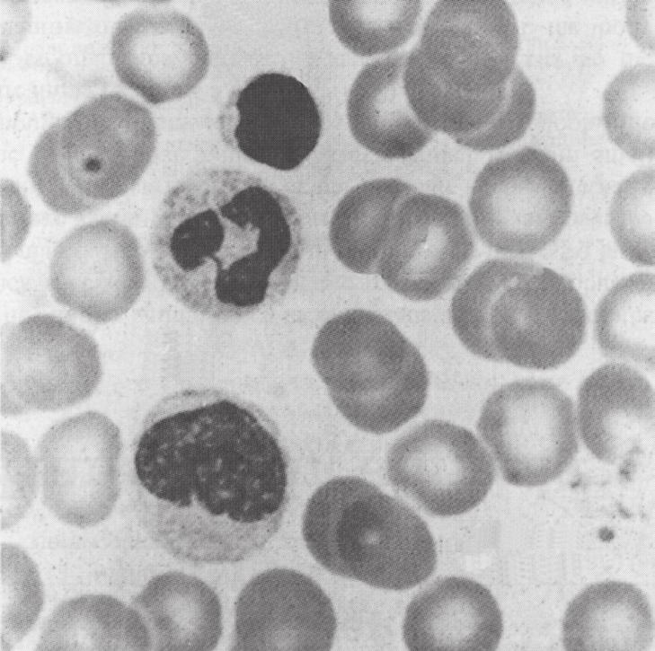 18 The photograph shows human blood cells as seen under a microscope at high power. 8 P Q S R Which are red cells? P and Q Q and R R and S S and P 19 The diagram shows someone blowing up a balloon.