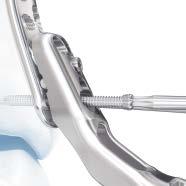 Be sure the plate is held securely to the bone to prevent rotation as the screw is locked to the