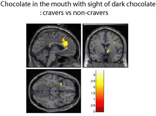 Decisions about the intensity of a stimulus recruit the primary sensory (insular taste) cortical area.