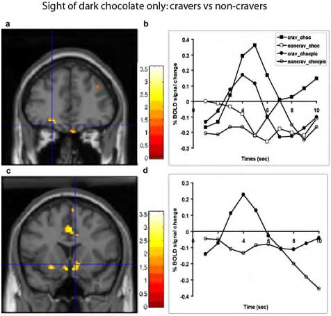 types of attention The flavour and sight of chocolate combination: more activation was found in the cravers than in the noncravers in the anterior and pregenual cingulate cortex, and in the ventral