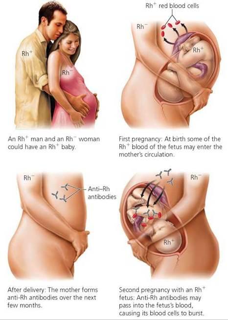 Doesn t affect the current baby, because the mother does not have the antibodies yet.