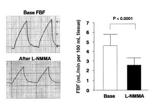 Invasive Endothelial Function Tests baseline blood flow after L-NMMA FBF