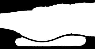 60 cm WATERBOLUS Rectum