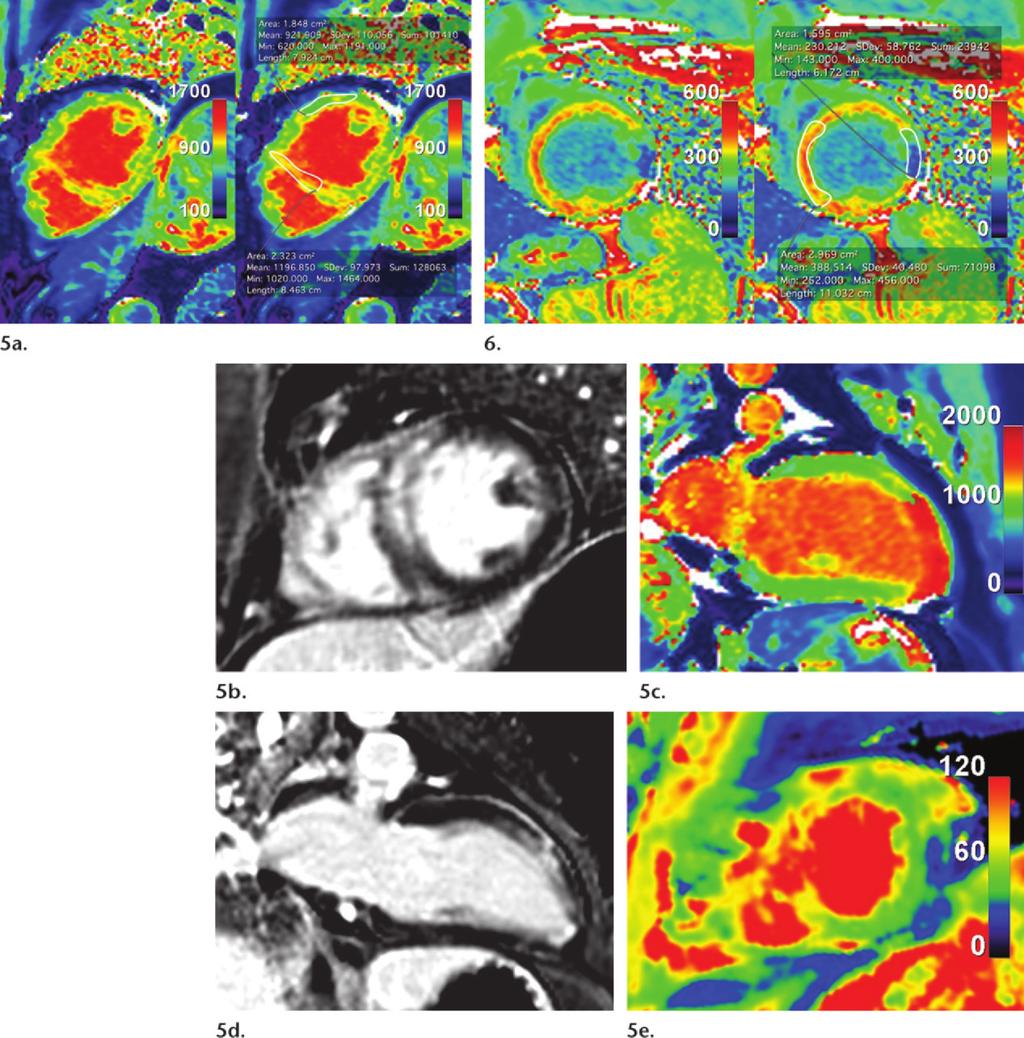 1602 October Special Issue 2014 radiographics.rsna.org Figures 5, 6.