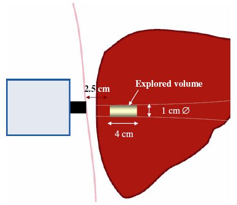 FibroScan Examination Explored volume TE: 1/500 of the liver