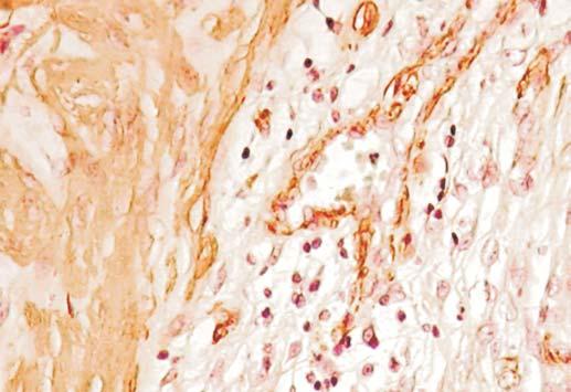 immunohistochemistry extend from the vessel surface