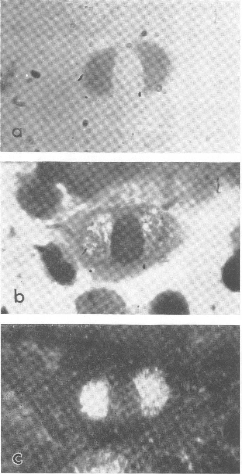 6e) fills the cytoplsm nd fluorescence of the virus prticles within the inclusion body (Figs 7c nd 8b). ruptures, liberting free elementry bodies (Fig. 6f) to repet the cycle in other cells.