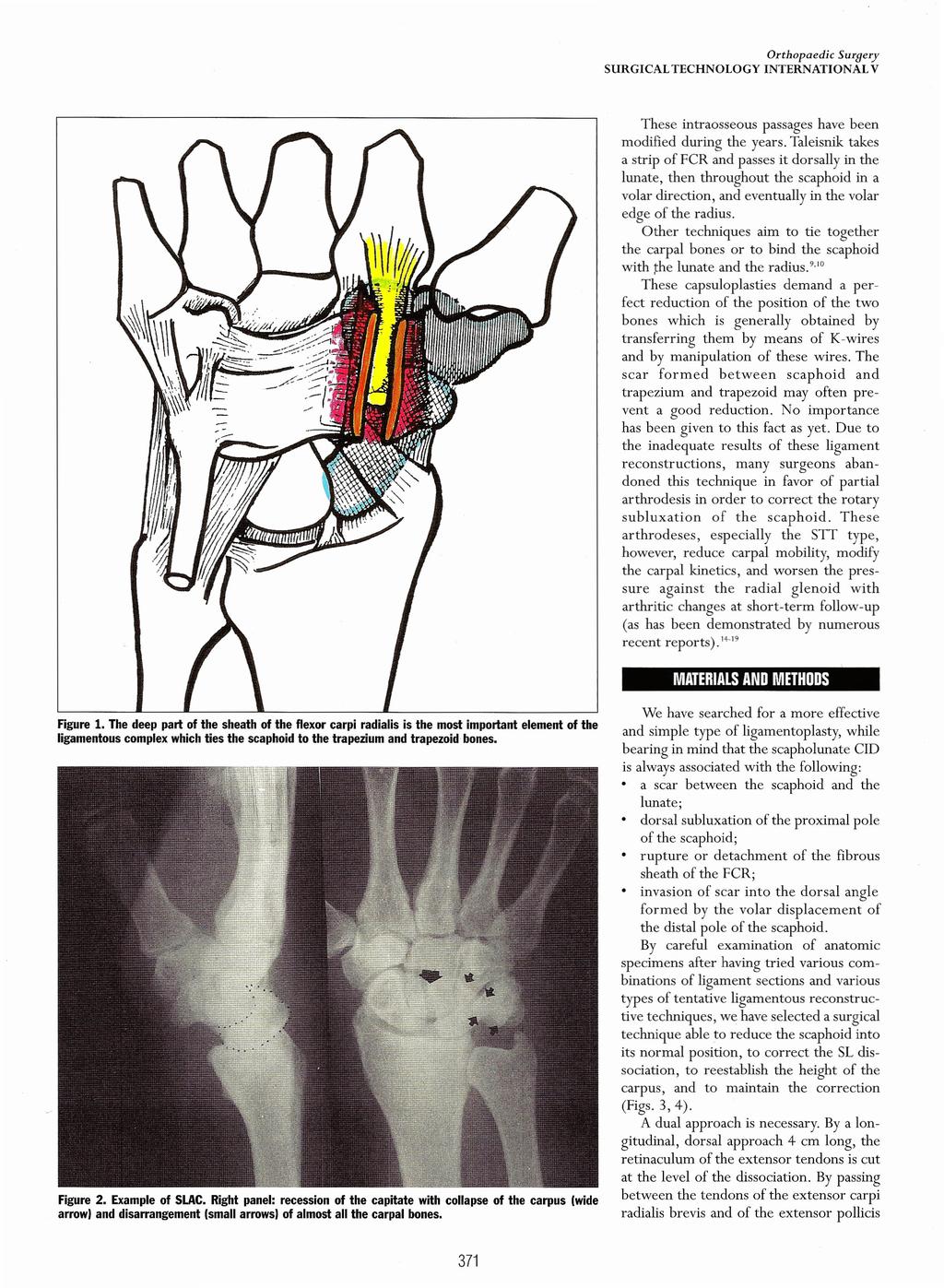 Orthopaedic SURGICAL TECHNOLOGY Surpery INTERNATIONAL V These intraosseous passages have been modified during the years.