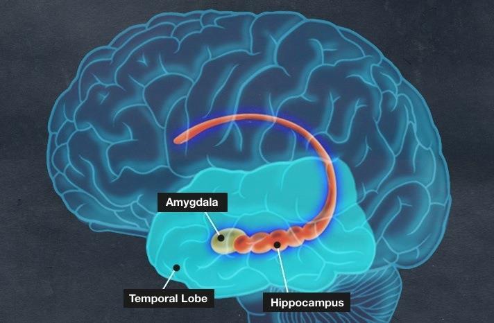 Various areas of the brain For episodic memory Hippocampus