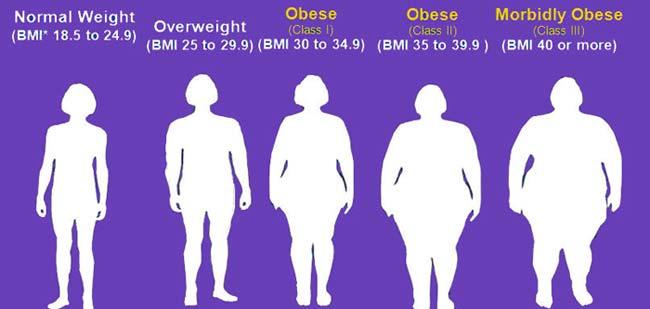 CLASSIFICATION OF OBESITY Excess adipose tissue cannot be
