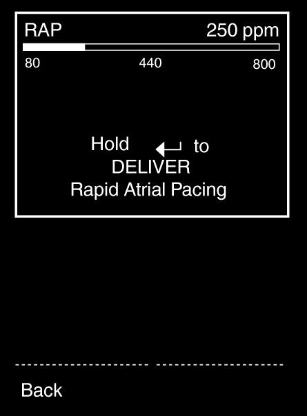 RAP (RAPID ATRIAL PACING) RAP can be used to interrupt some types of atrial tachycardias or to induce an atrial tachycardia. Caution: RAP is for atrial use only.