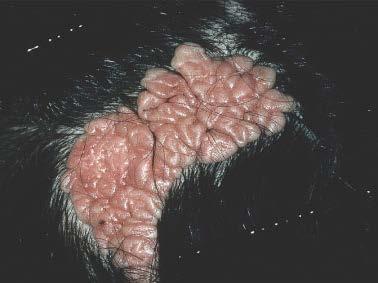 Sebaceous naevus Common on scalp and head and