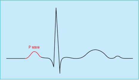 Step 4: P Waves and PR Interval P wave: