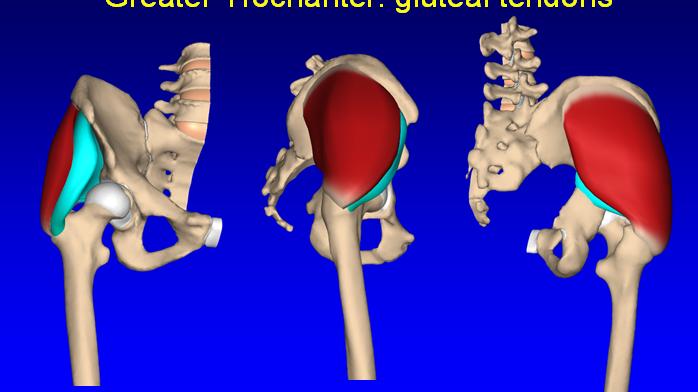 Greater Trochanter: Anatomy and Pathology Jon A.