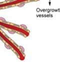 causee new blood vessels to