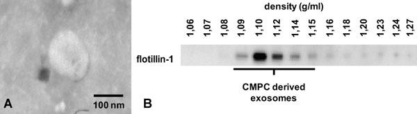 Fig. 1 Exosome isolation of CMPCs.