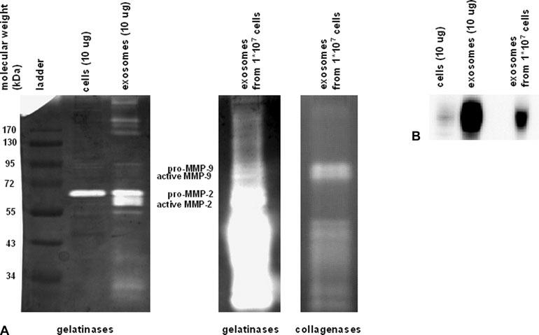 Fig. 3 MMPs and EMMPRIN are present in CMPC-derived exosomes. (A) A zymogram was performed to detect gelatolytic MMP activity within the exosomes.