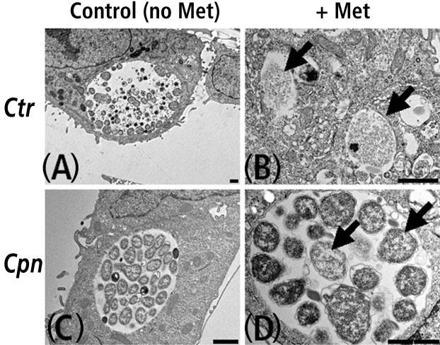 H. M. Al-Younes and others Fig. 3. Transmission electron micrographs of Met-treated and untreated HEp-2 cells infected with either C. trachomatis or C. pneumoniae. Cells were infected with C.
