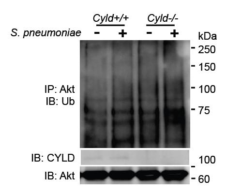 Supplementary Figure S8. S. pneumoniae induces endogenous Akt ubiquitination, and CYLD deubiquitinates it.