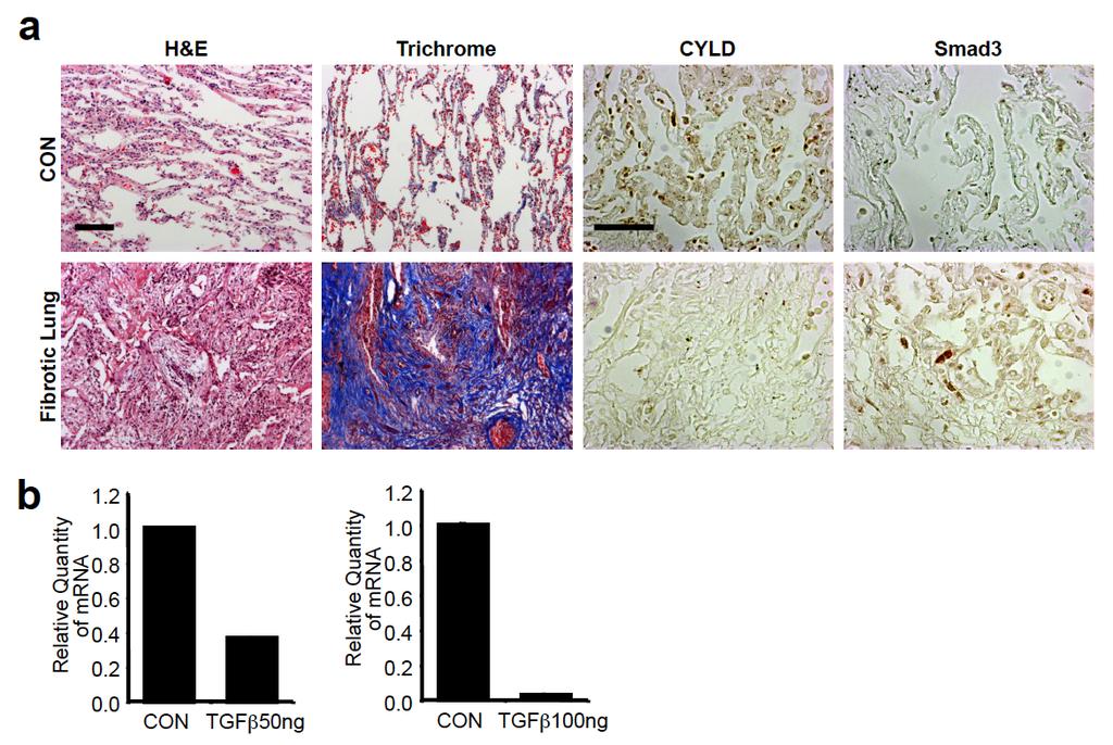 Supplementary Figure S2. Expression of CYLD is lower in fibrotic lung tissue.