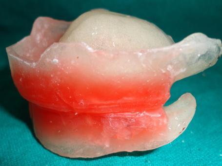 techniques of flasking, curing and polishing the denture.