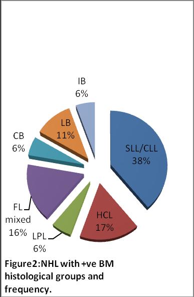lymphoma of low grade malignancy exhibited a significantly (P < 0.05) higher frequency of bone marrow involvement than patients with malignant lymphoma of high grade malignancy, (figure 1).