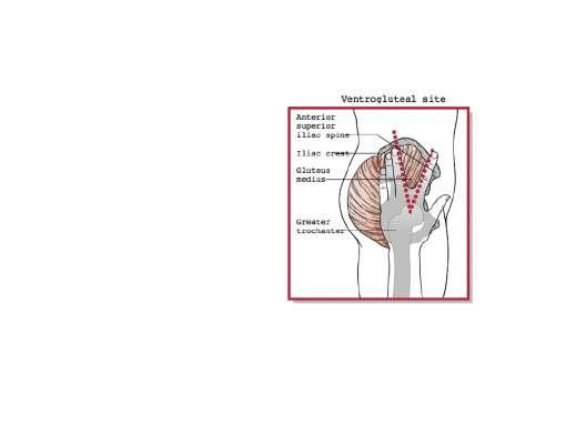 Intramuscular injections Site