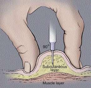 - insert the needle into the patient skin at a 45 o or 90 angle -Aspirate before injection to