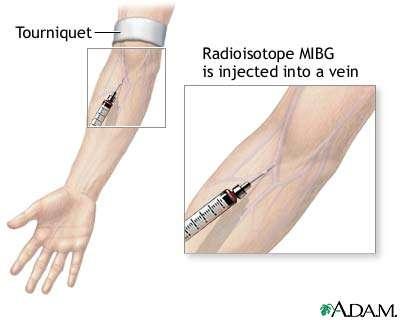 Intravenous injections Injected