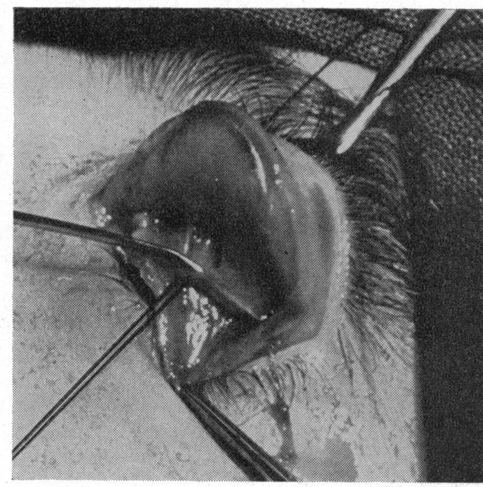 SURGICAL ANATOMY OF THE LEVATOR PALPEBRAE INSERTION 509 The aponeurosis can be picked up with sutures or fine forceps and incised (Fig. 10).