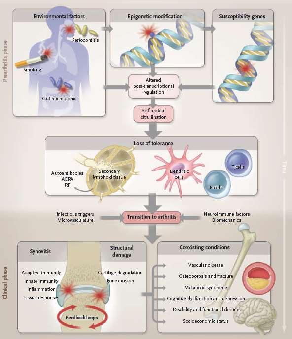 The pathogenesis of rheumatoid arthritis Iain B.