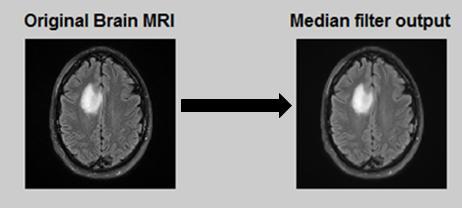 For example, the skull lining in MRI is free from tumor and should be removed beforehand to reduce processing time of algorithms on skull area.