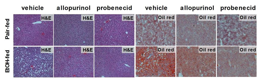 Therapeutic depletion of uric acid ameliorates alcoholic liver disease in mice Lieber-DeCarli