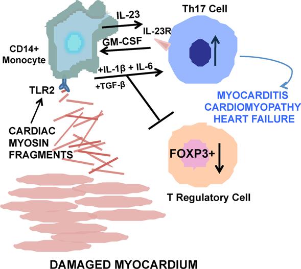 Figure 10. Diagram of pathogenic mechanisms in the Th17 immunophenotype in human myocarditis.