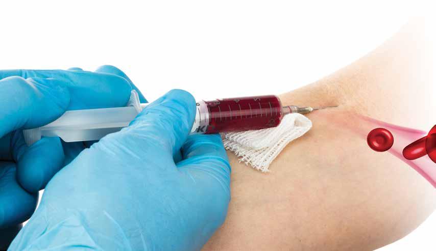 Venipuncture/Phlebotomy Techniques Learn when phlebotomy and PRP are considered