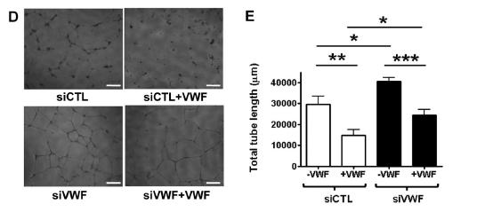 VWF and angiogenesis Ø Inhibition of VWF expression in human umbilical vein EC (HUVEC) using sirna resulted in increased proliferation, migration and in vitro angiogenesis HUVEC ± VWF-siRNA ±