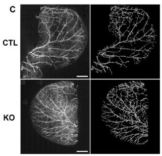 angiogenesis and vascular density were found to be increased in the VWF deficient mouse, (in several physiological and pathological models) Blood vessels (anti-α-smooth muscle actin-cy3) in