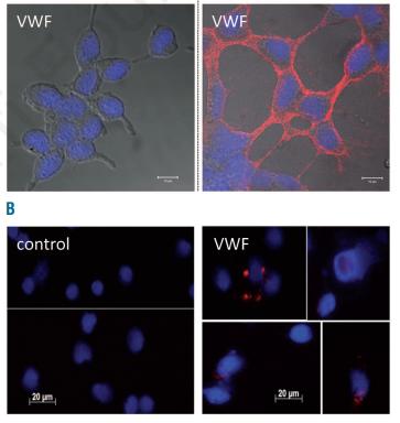 the immune cell receptor Siglec-5 has been identified as a receptor for VWF HEK293 HEK293-Siglec-5 DUOLINK Monocyte + PMA no VWF Pegon J, Casari C et al Haematologica 2012 Monocyte + PMA + VWF To