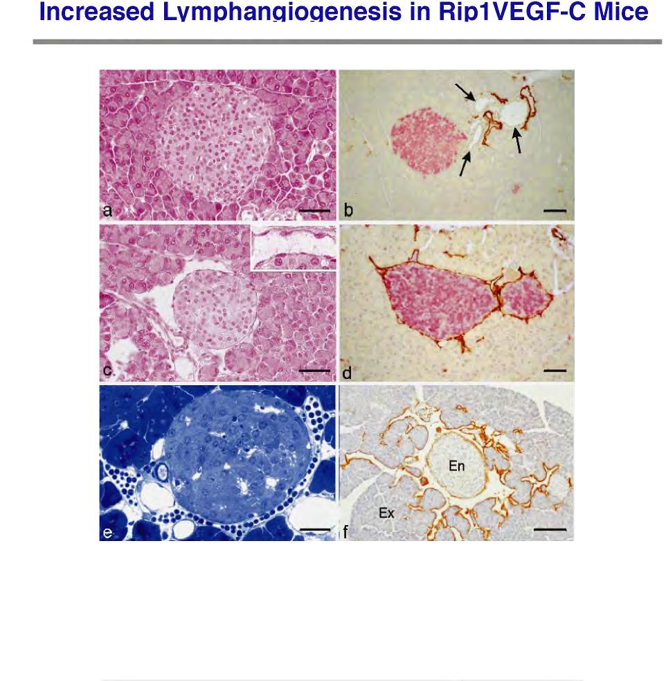 Forced Lymphangiogenesis in Rip1VEGF-C