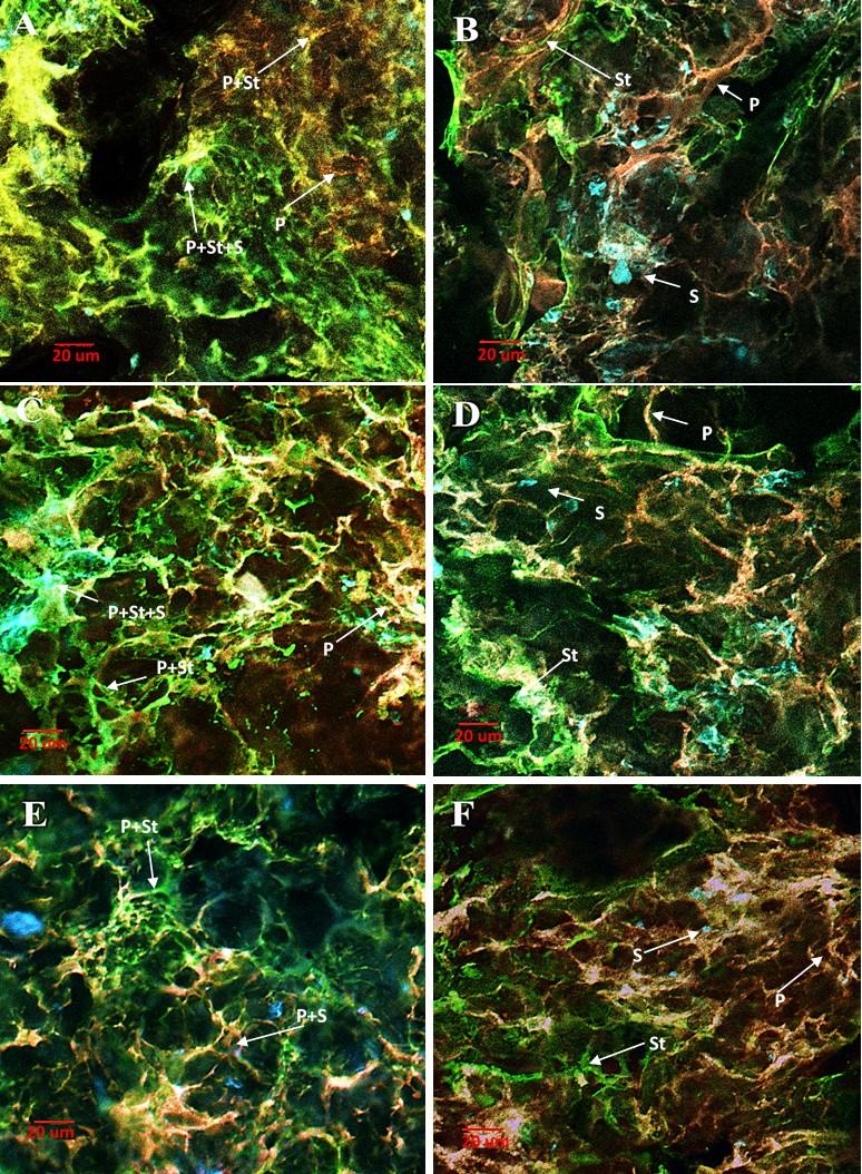 Figure 6.5 Confocal scanning laser micrographs of angel food cakes at day 1 (A, C, E) and 3 of storage (B, D, F).