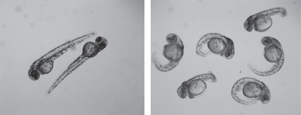 T. Evangelista et al. / Limb-Girdle CMS S27 Fig. 3. Zebrafish a) Control; b) GFPT1 morpholino, showing altered tail morphology.
