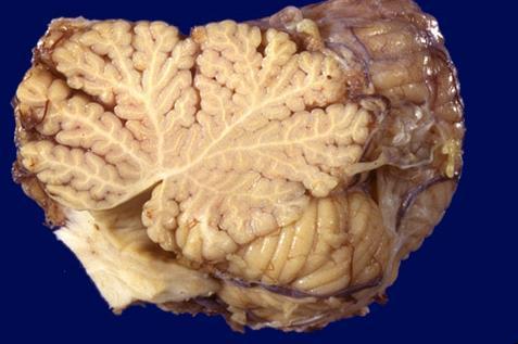 Lobes and Lobules of the Cerebellar Cortex