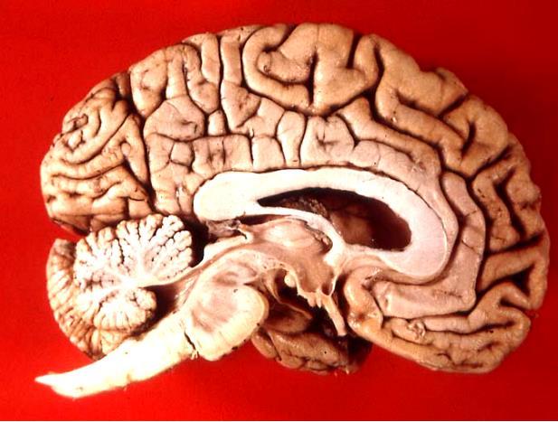 Cerebellum The Little Brain 2 The