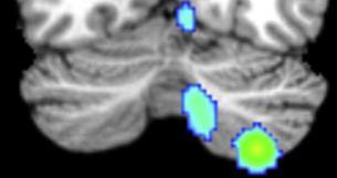 FMRI Mapping pf Cerebellar Involvement in Various
